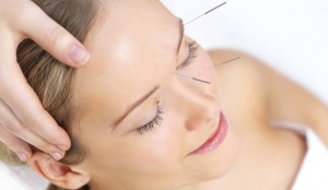 acupuntura