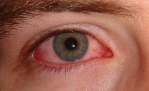 ojos