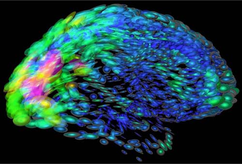 Vitaminas para el cerebro