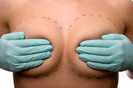 Amamantar con implantes: ¿Es posible?