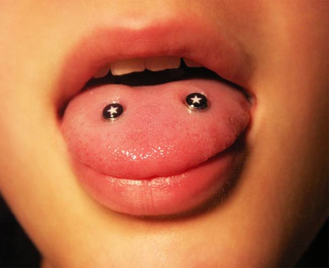 Las complicaciones del piercing