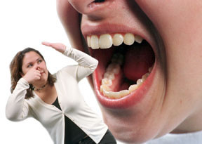 Las causas de la halitosis