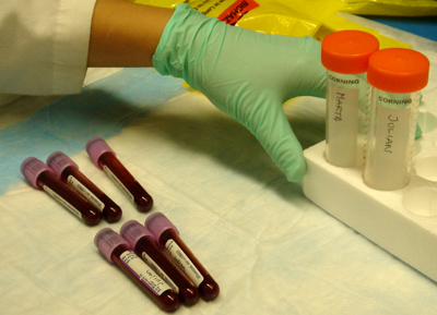 ¿Cómo interpretar los análisis de sangre? Estudio metabólico