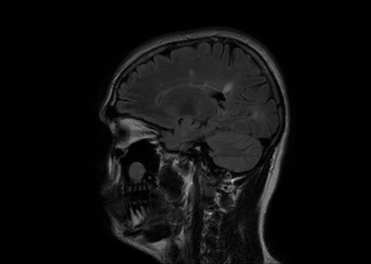 Una perfecta depilación para el rostro