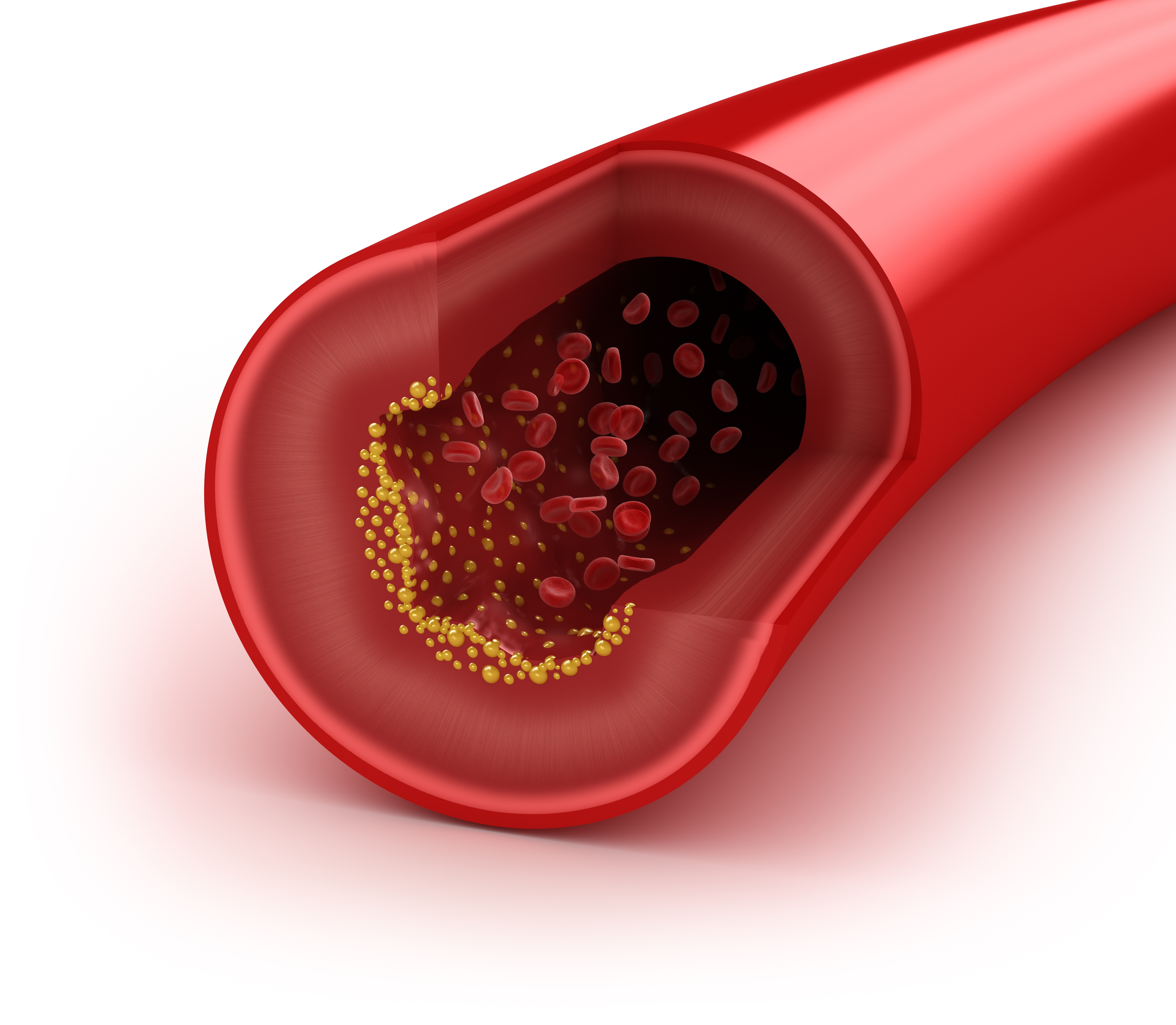 Desmontando mitos sobre el colesterol