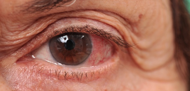 ¿Cómo cuidar tus ojos?