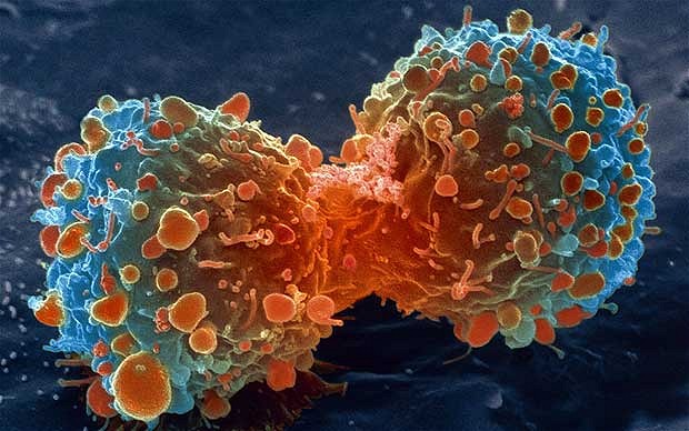 El estilo de vida en la aparición del cáncer