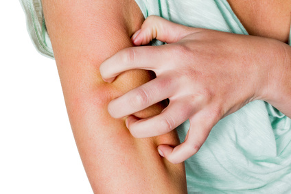 La urticaria crónica: ¿Qué es y cómo se trata?