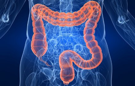 5 alimentos que debes evitar si tienes colon irritable